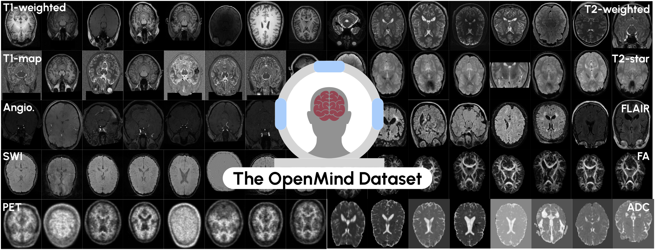 OpenMind