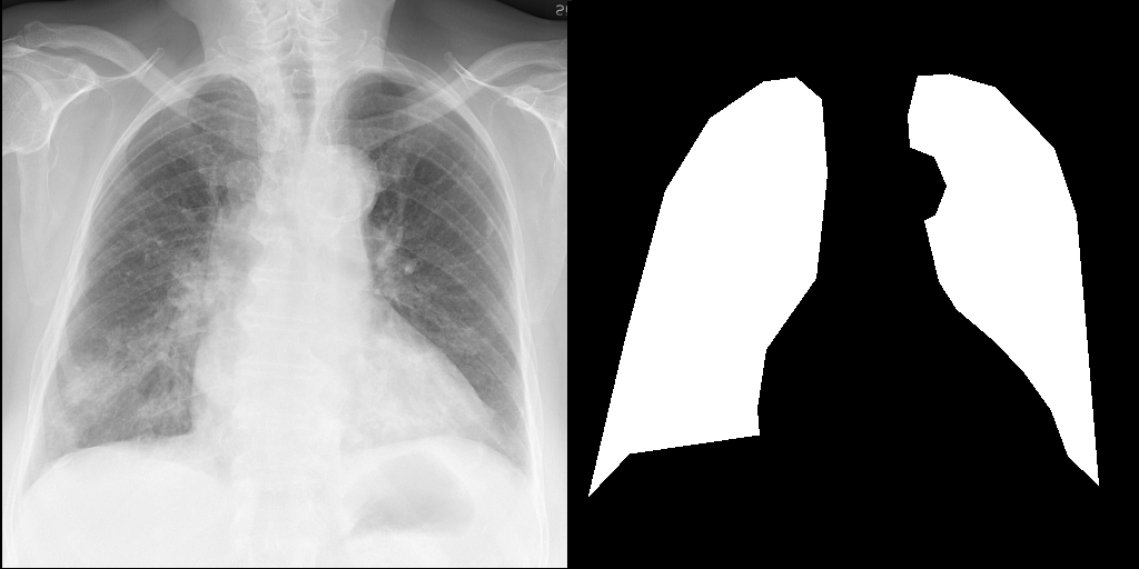 RadEdit Edited Inputs